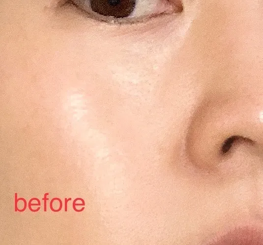 フェイシャル 40代