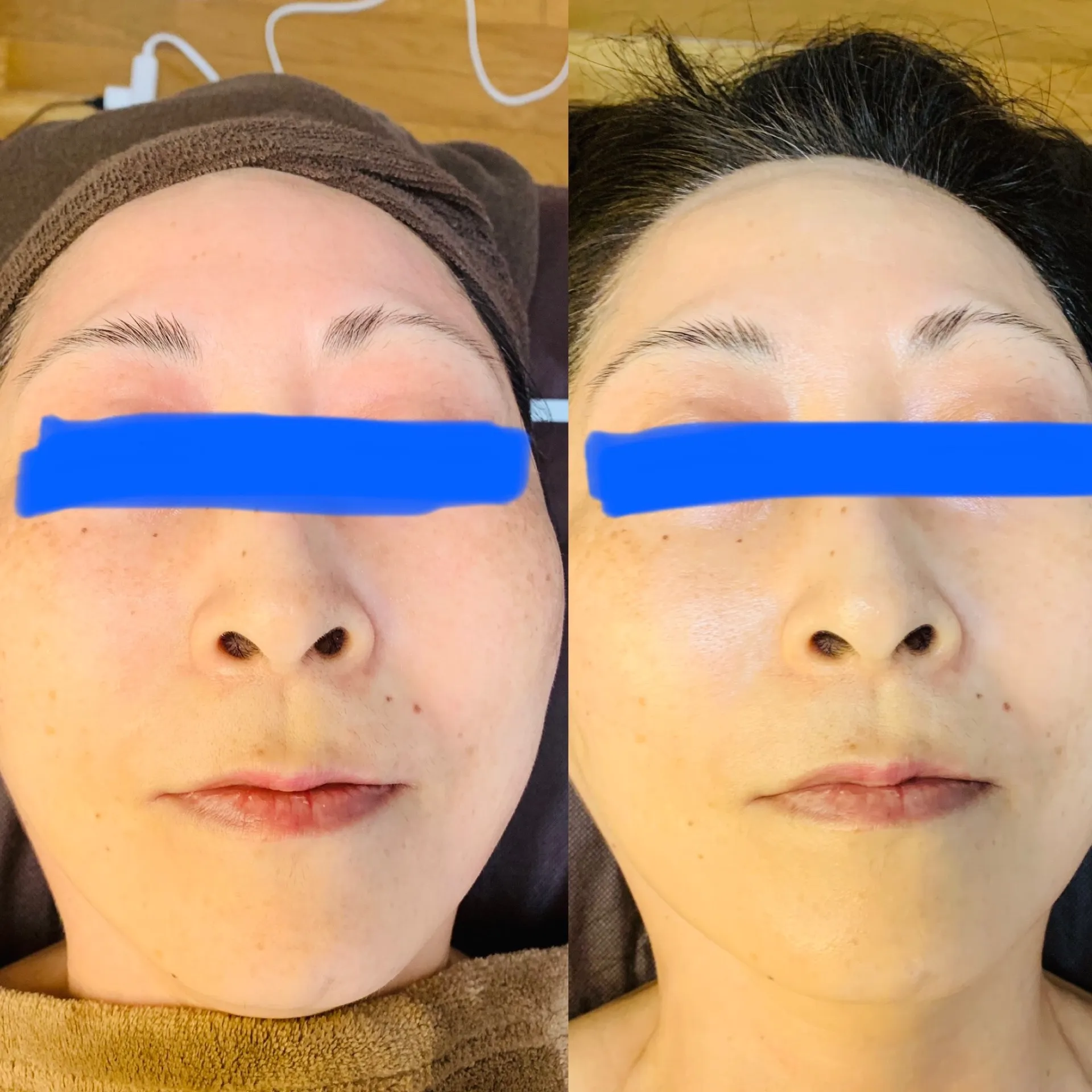 フェイシャル 敏感肌/乾燥肌 50代